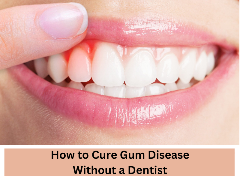 how to cure gum disease without a dentist